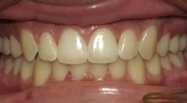 Jesus-After-Teeth