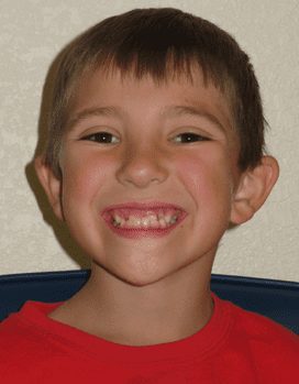 Luke-Before-Face