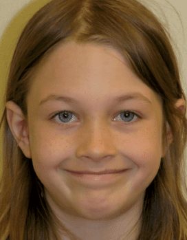 Merydith-Before-Face